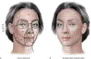 Face Harley Clinic
