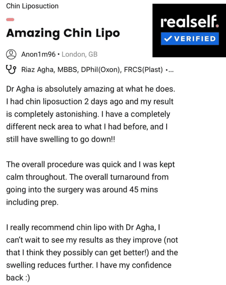 Chin liposuction review, at The Harley Clinic, London