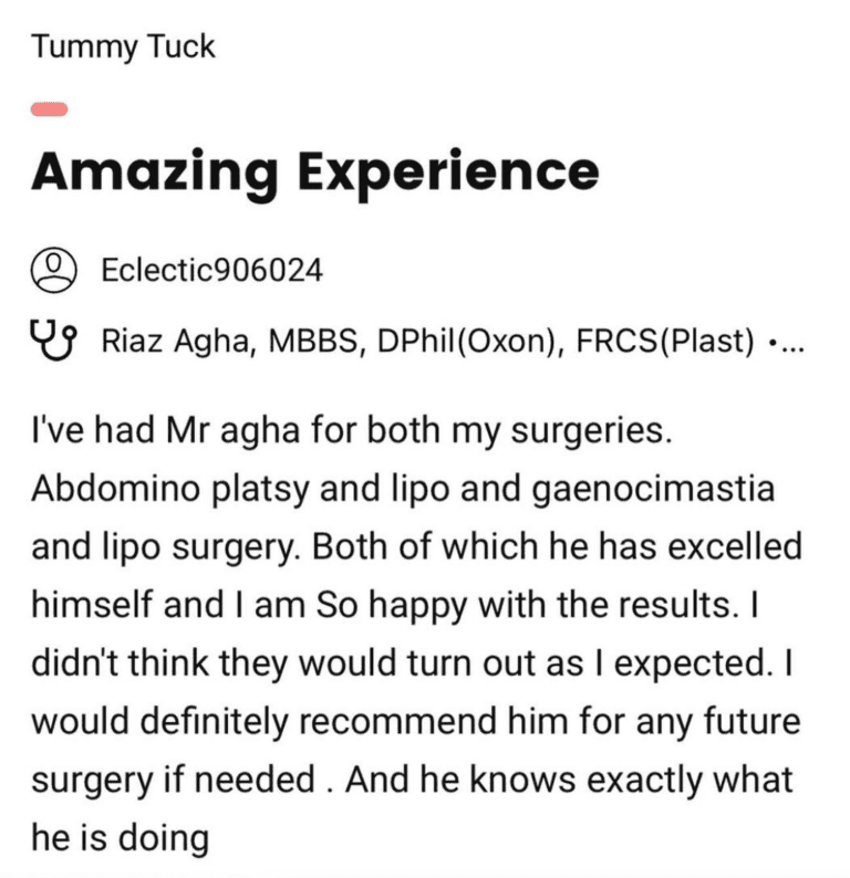 Tummy tuck review - Dr Riaz Agha at the Harley Clinic