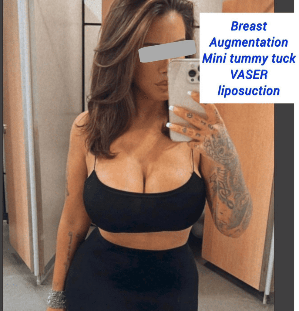 Breast augmentation, mini tummy tuck, and Vaser liposuction at the Harley Clinic