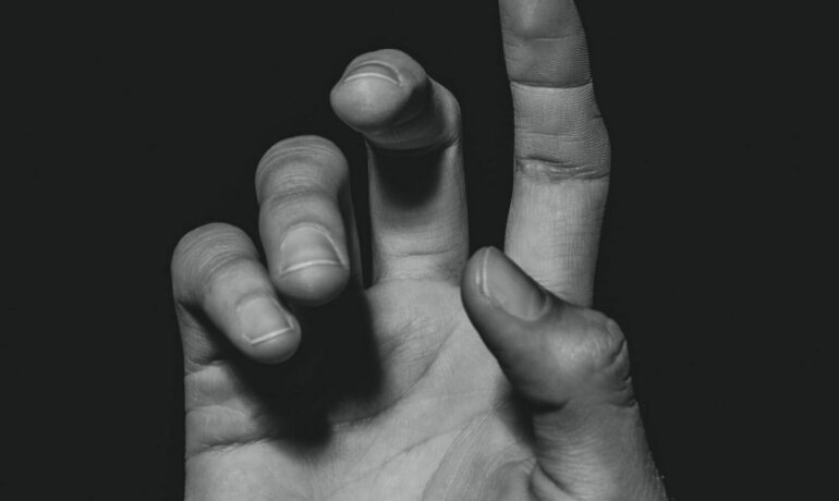Trigger Finger vs Dupuytren’s Contracture