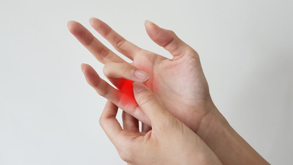 Enfermedad del dedo en gatillo (dedo bloqueado o trastorno de tenosinovitis estenosante), anatomía de la mano con resaltado en el área dolorosa. El paciente tiene dolor en la palma y problema de pellizco. concepto de síntoma médico