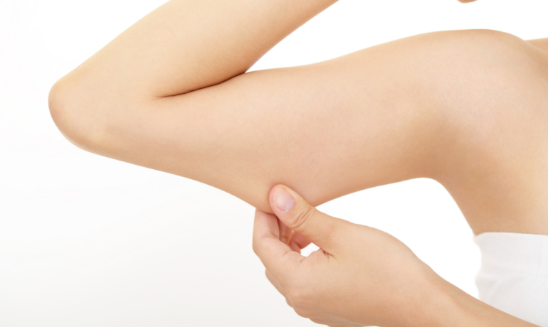 Arm Lift Surgery