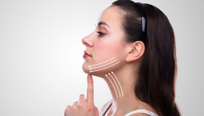 neck lift