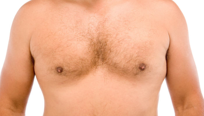 How to Get Rid of Man Boobs
