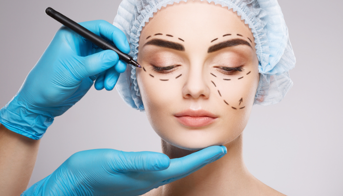Eyelid Surgery