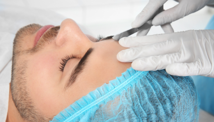 brow lift for men