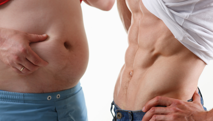 Men's Tummy Tuck