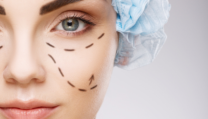 Woman being prepped for lower blepharoplasty